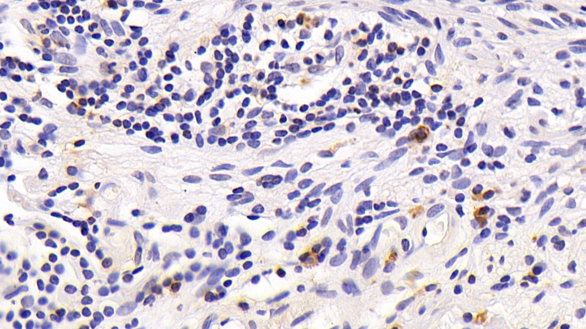 Monoclonal Antibody to Cluster Of Differentiation 8a (CD8a)