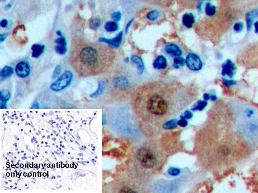 Monoclonal Antibody to Arginase (ARG)