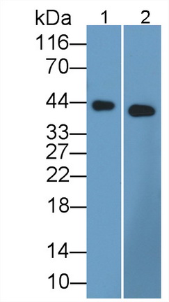 Monoclonal Antibody to Arginase (ARG)