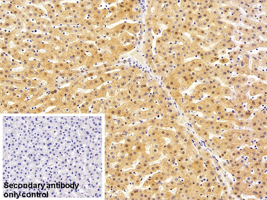 Monoclonal Antibody to Arginase (ARG)