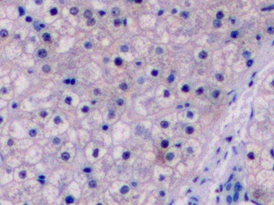 Monoclonal Antibody to Arginase (ARG)