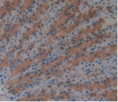 Monoclonal Antibody to Arginase (ARG)