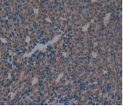 Monoclonal Antibody to Arginase (ARG)