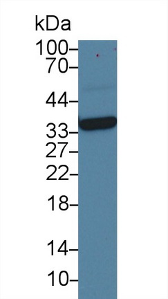 Monoclonal Antibody to Arginase (ARG)