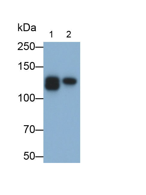 Monoclonal Antibody to Sialic Acid Binding Ig Like Lectin 2 (CD22)