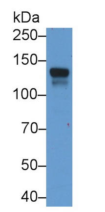 Monoclonal Antibody to Sialic Acid Binding Ig Like Lectin 2 (CD22)