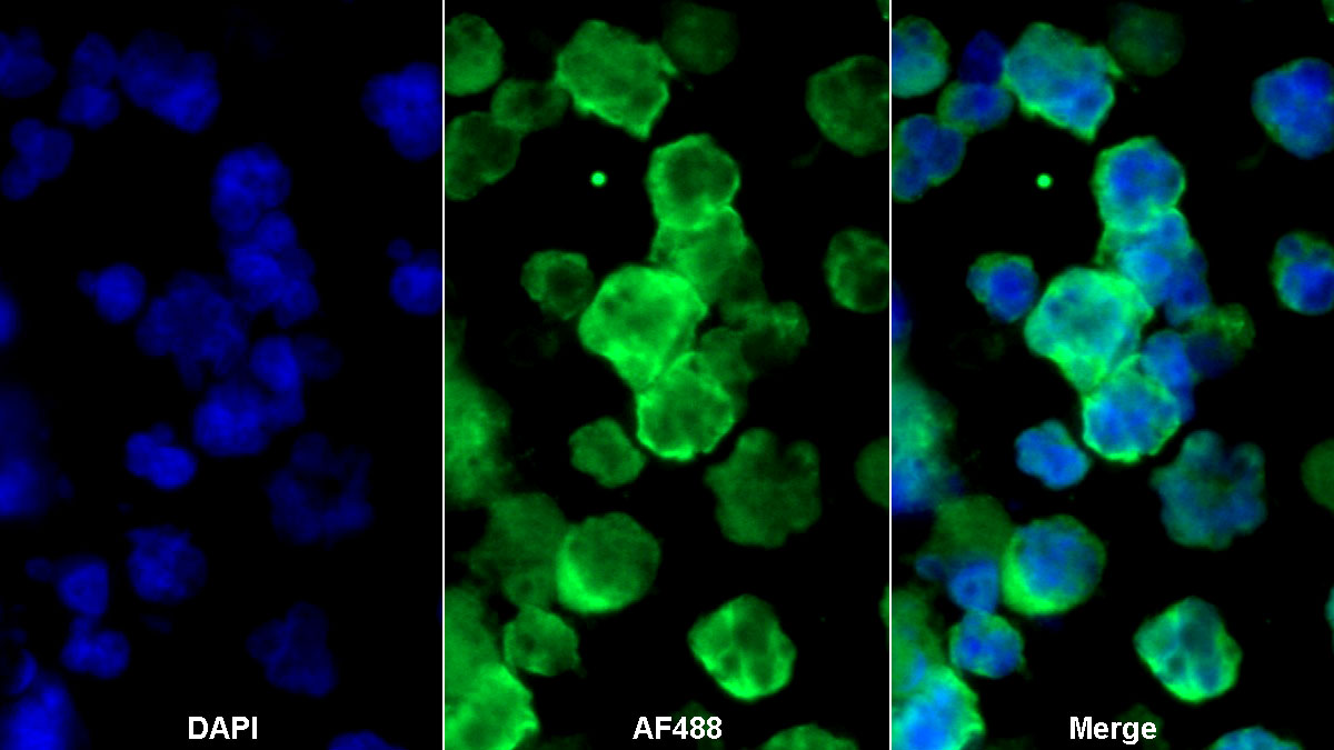 Monoclonal Antibody to Sialic Acid Binding Ig Like Lectin 2 (CD22)