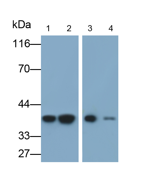 Monoclonal Antibody to Membrane Spanning 4 Domains Subfamily A, Member 1 (CD20)