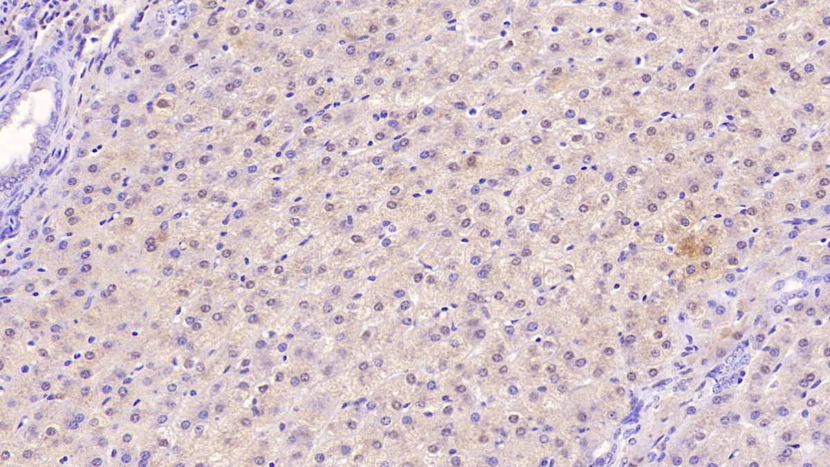 Monoclonal Antibody to Transferrin Receptor (TFR)