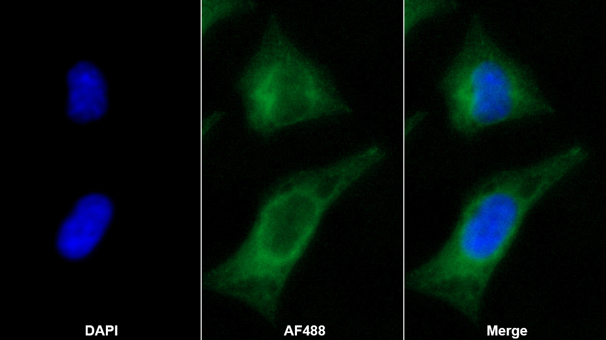 Monoclonal Antibody to Clusterin (CLU)