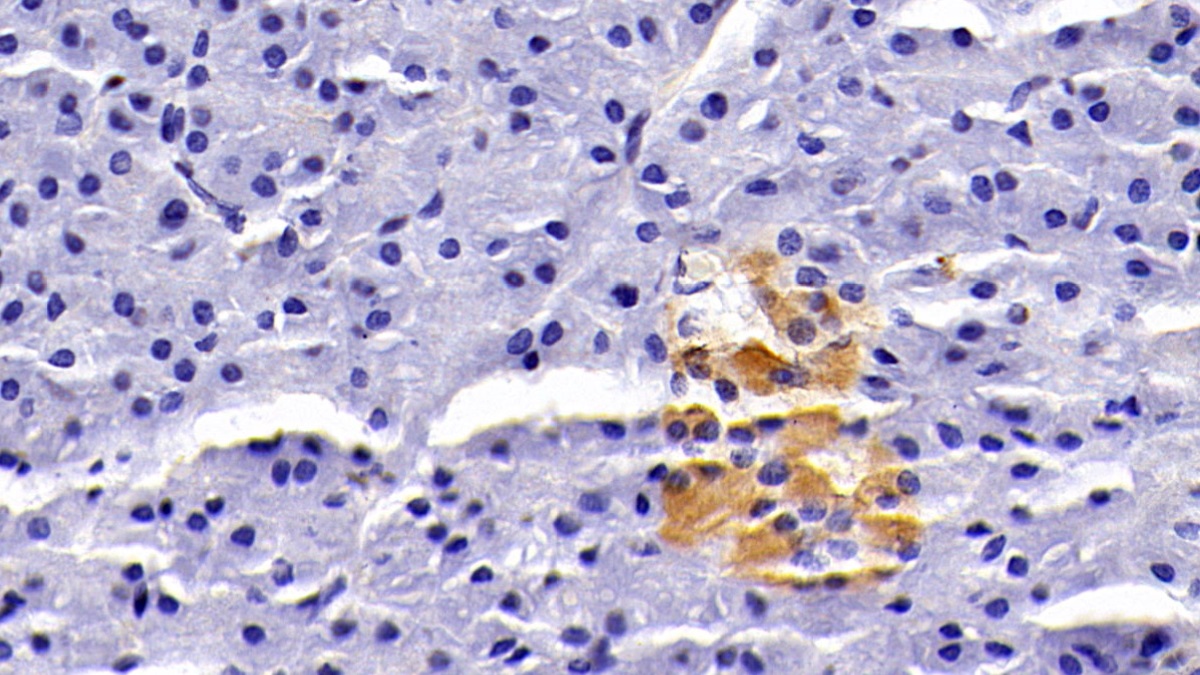 Monoclonal Antibody to Clusterin (CLU)