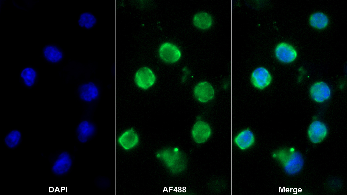 Monoclonal Antibody to Granzyme K (GZMK)
