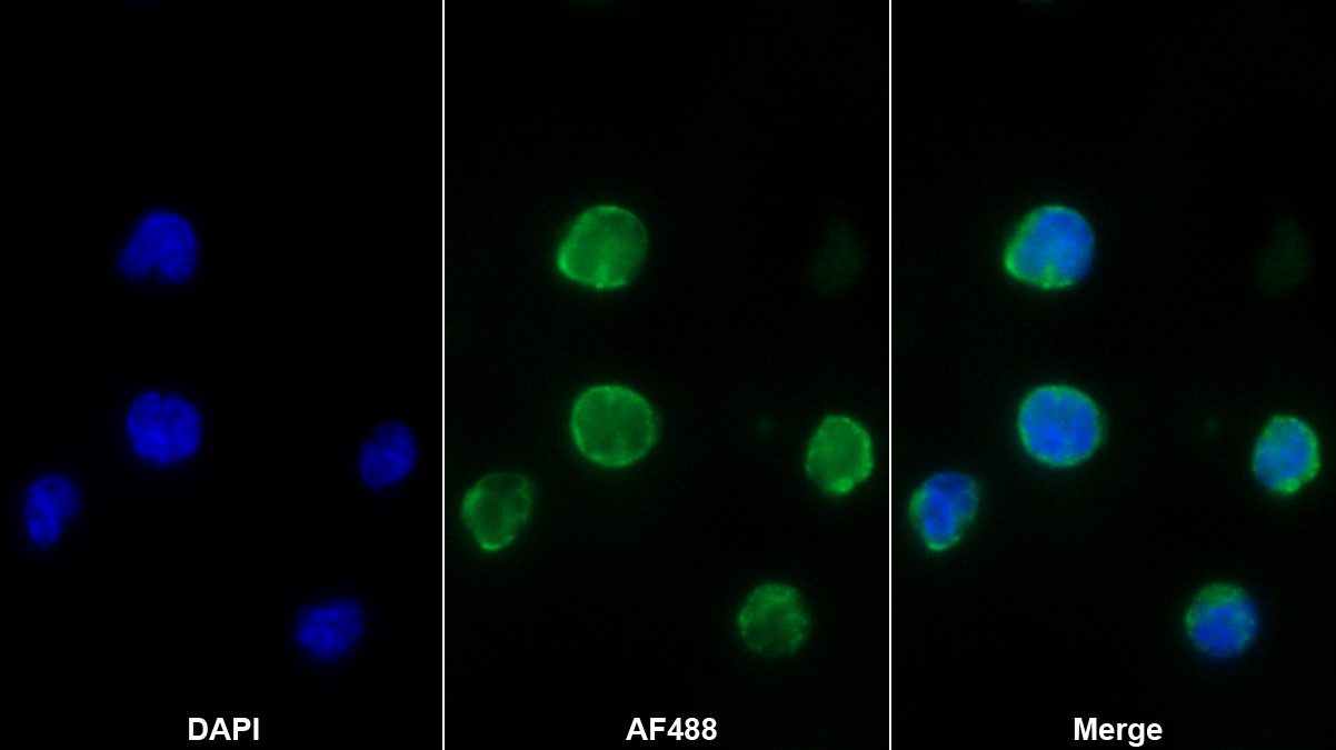 Monoclonal Antibody to Granzyme K (GZMK)