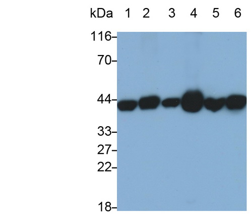 Monoclonal Antibody to Aspartate Aminotransferase (AST)