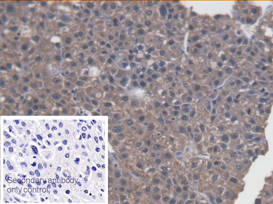 Monoclonal Antibody to Aspartate Aminotransferase (AST)