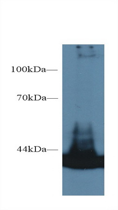 Monoclonal Antibody to Aspartate Aminotransferase (AST)