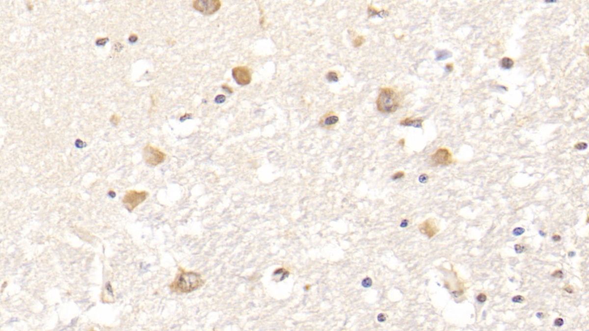 Monoclonal Antibody to Fibrinogen Beta Chain (FGB)