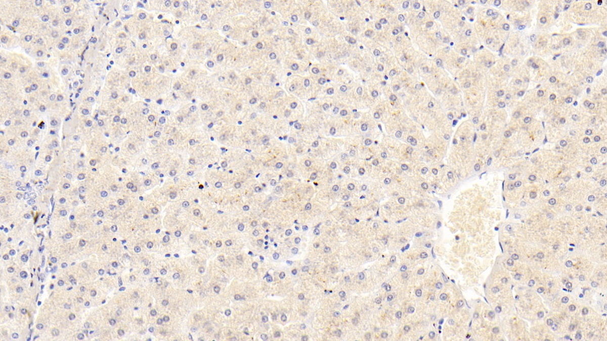 Monoclonal Antibody to Fibrinogen Beta Chain (FGB)