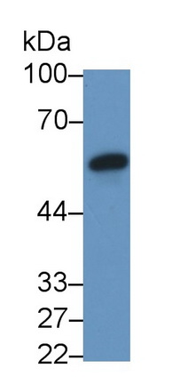 Monoclonal Antibody to Fibrinogen Beta Chain (FGB)