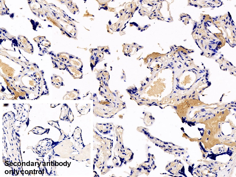 Monoclonal Antibody to Fibrinogen Beta Chain (FGB)