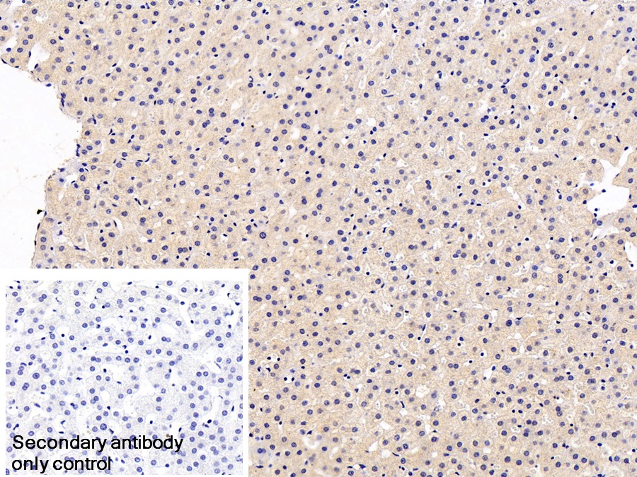 Monoclonal Antibody to Fibrinogen Beta Chain (FGB)