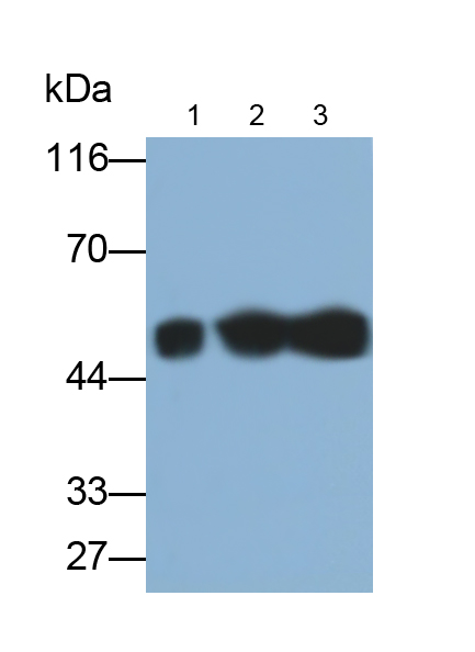 Monoclonal Antibody to Fibrinogen Beta Chain (FGB)