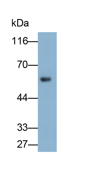 Monoclonal Antibody to Fibrinogen Beta Chain (FGB)