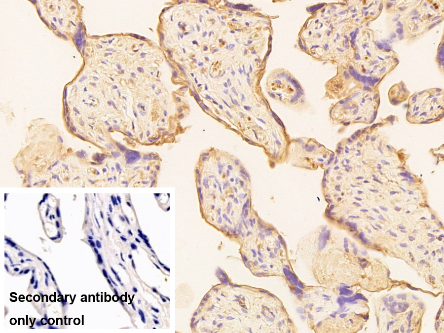 Monoclonal Antibody to Alkaline Phosphatase, Placental (ALPP)