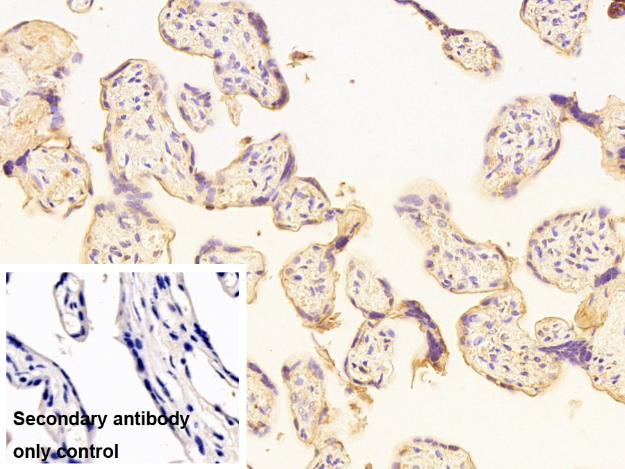 Monoclonal Antibody to Alkaline Phosphatase, Placental (ALPP)