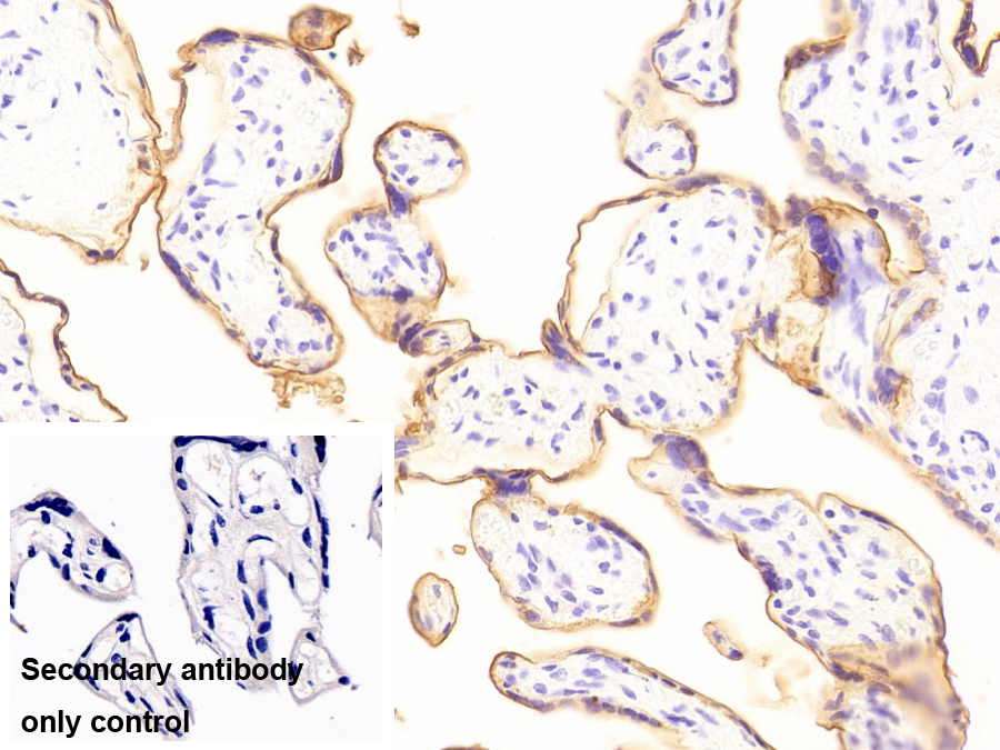 Monoclonal Antibody to Alkaline Phosphatase, Placental (ALPP)