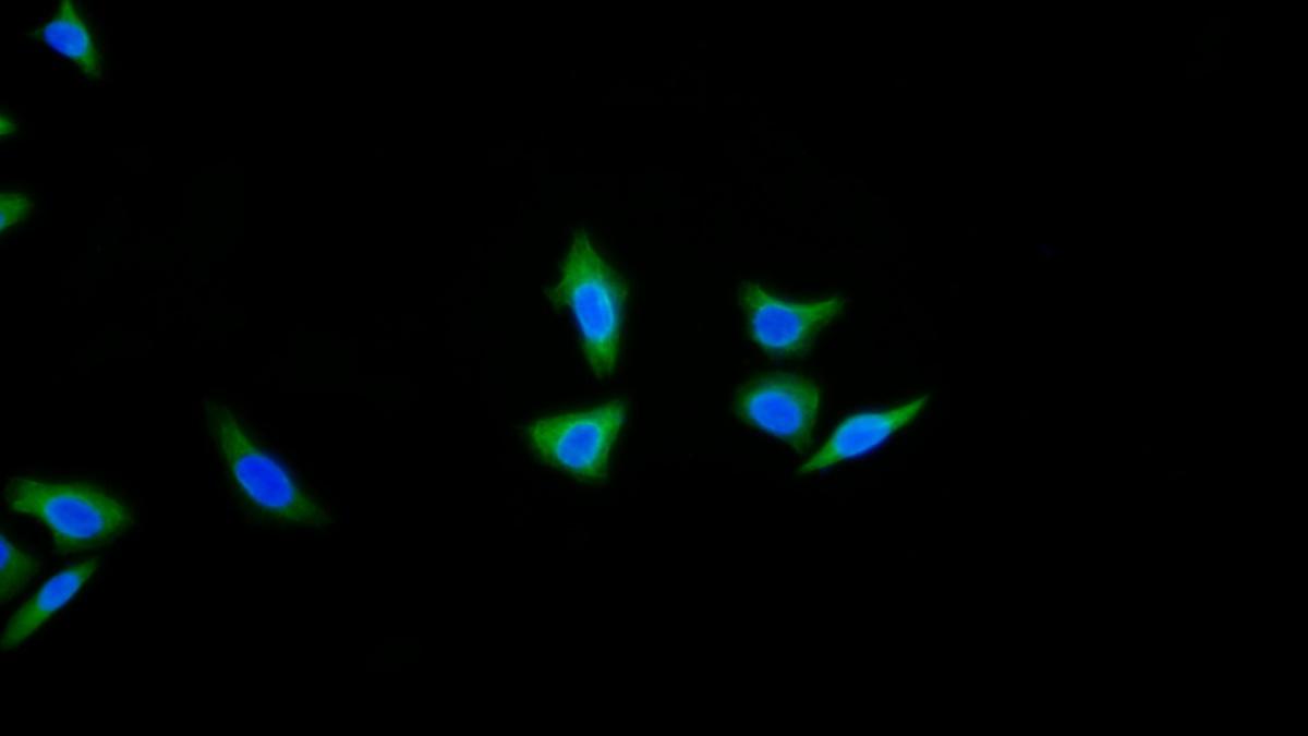 Monoclonal Antibody to Cytokeratin 18 (CK18)