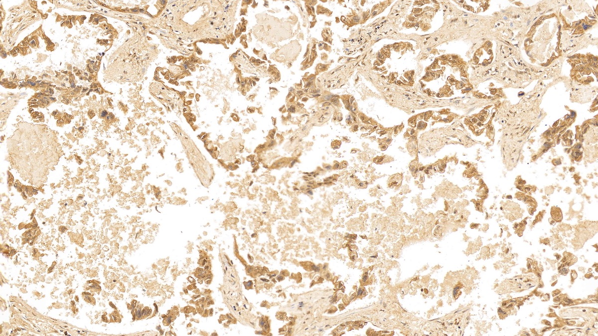 Monoclonal Antibody to Cytokeratin 18 (CK18)