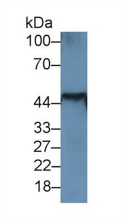 Monoclonal Antibody to Cytokeratin 18 (CK18)