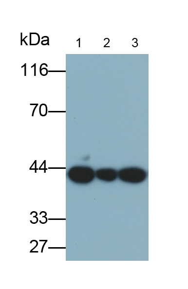 Monoclonal Antibody to Cytokeratin 18 (CK18)
