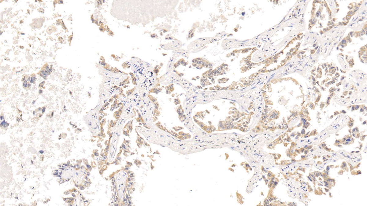 Monoclonal Antibody to Cytokeratin 18 (CK18)