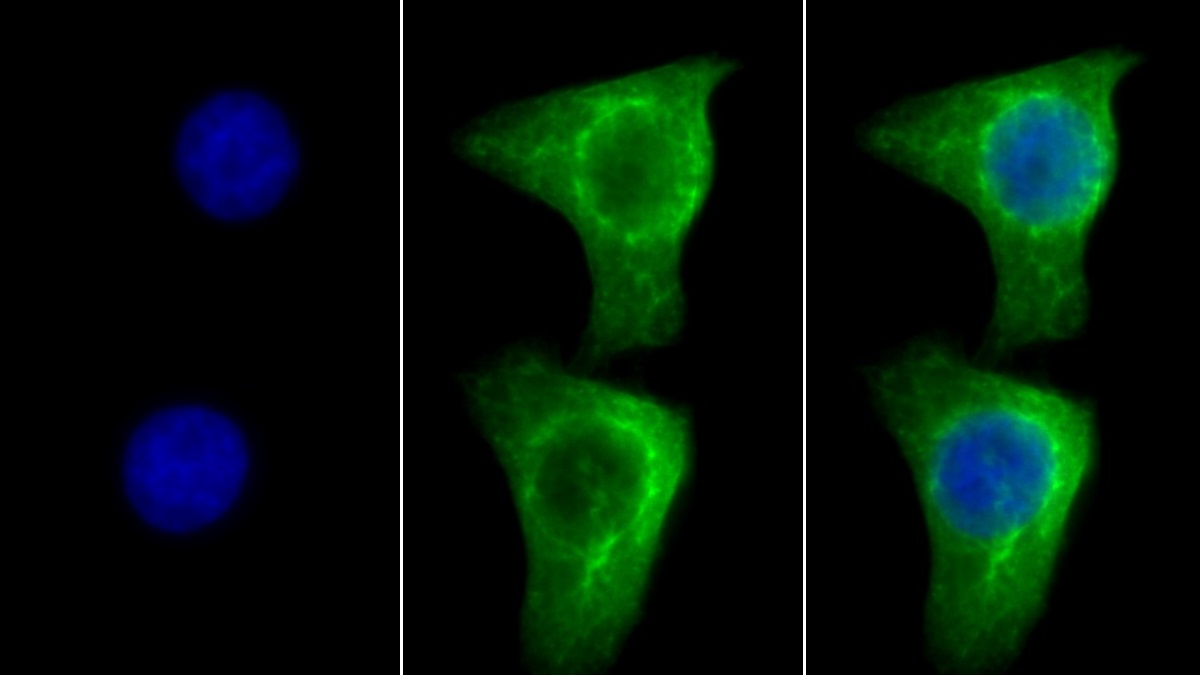 Monoclonal Antibody to Cytokeratin 18 (CK18)