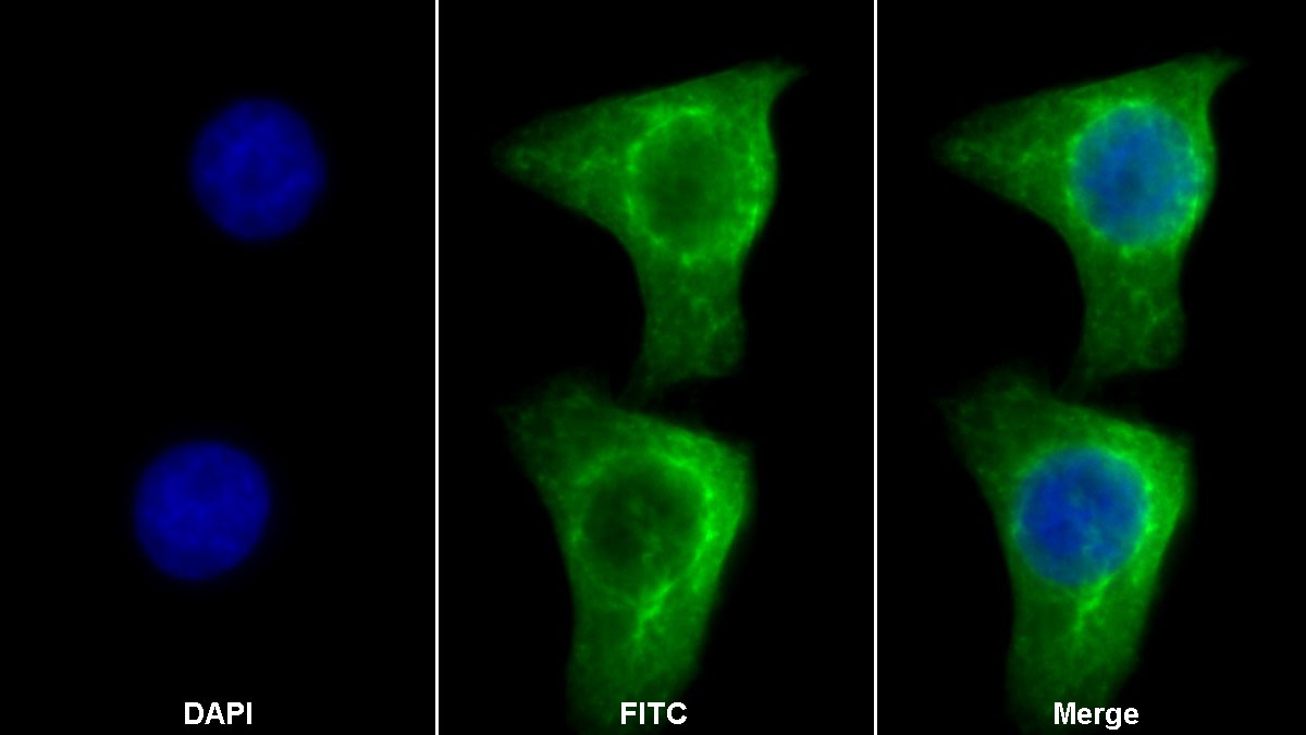 Monoclonal Antibody to Cytokeratin 18 (CK18)