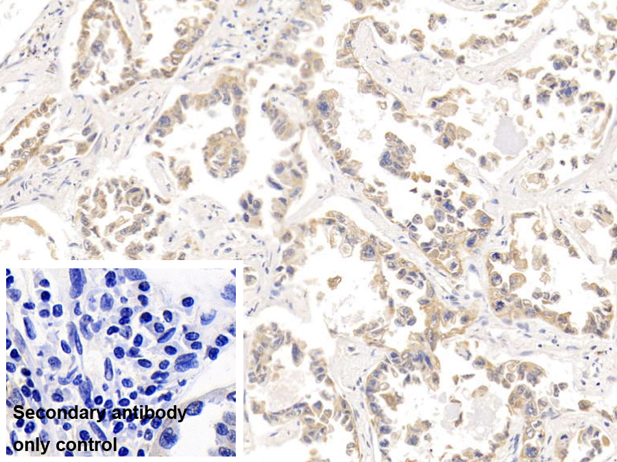 Monoclonal Antibody to Cytokeratin 18 (CK18)