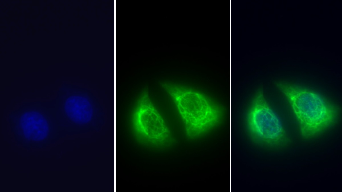 Monoclonal Antibody to Cytokeratin 18 (CK18)