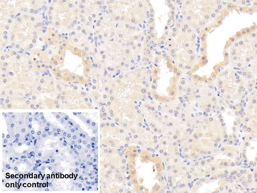 Monoclonal Antibody to Plasminogen (Plg)