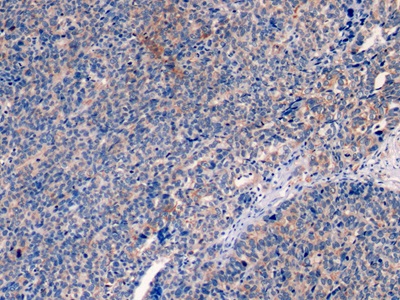 Monoclonal Antibody to Cytokeratin 19 (CK19)