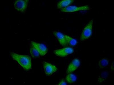 Monoclonal Antibody to Cytokeratin 19 (CK19)