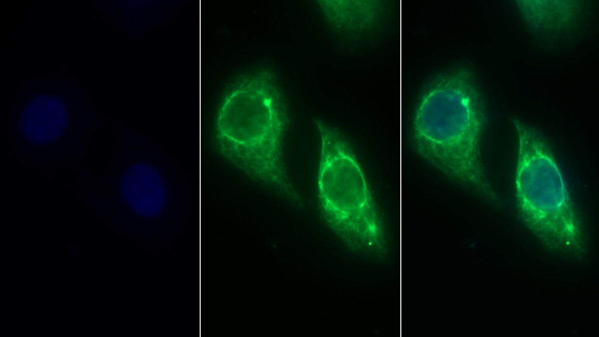 Monoclonal Antibody to Cytokeratin 19 (CK19)