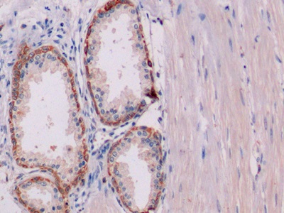 Monoclonal Antibody to Cytokeratin 19 (CK19)