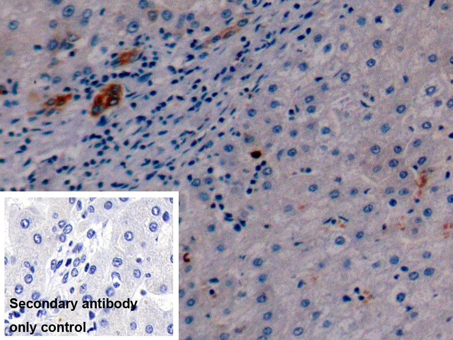 Monoclonal Antibody to Cytokeratin 19 (CK19)
