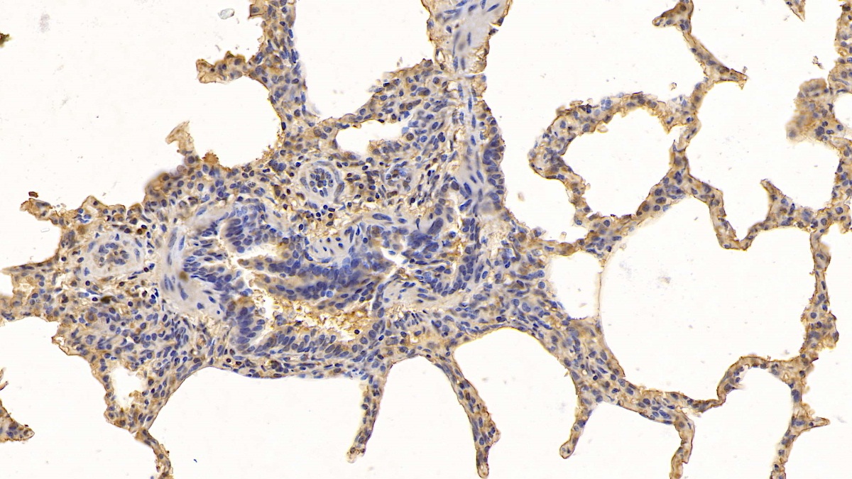 Monoclonal Antibody to Heart-type Fatty Acid Binding Protein (H-FABP)