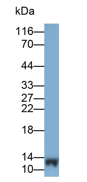 Monoclonal Antibody to Heart-type Fatty Acid Binding Protein (H-FABP)