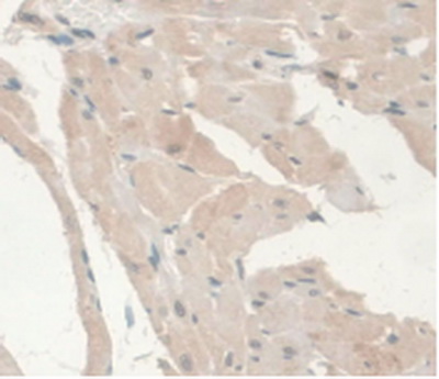 Monoclonal Antibody to Androgen Receptor (AR)