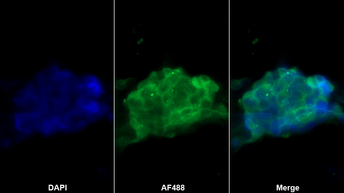 Monoclonal Antibody to Angiostatin (ANG)
