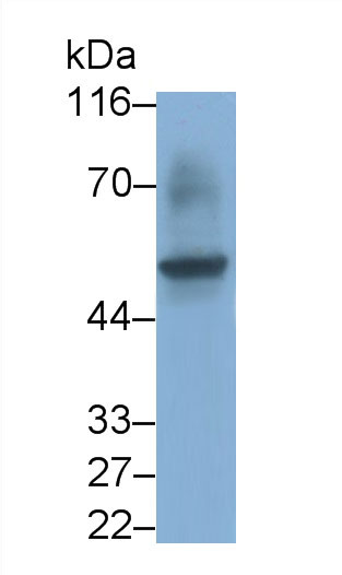 Monoclonal Antibody to Fc Fragment Of IgG Low Affinity IIIa Receptor (FcgR3A)